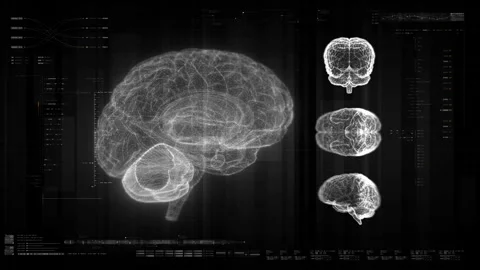 Advance Biomedical Neuron Pathology And Diagnostic Scan Stock Footage 310928131