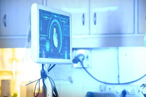 Advance scanning machine computer screen at hospital. modern medical equipmen Stock Photos
