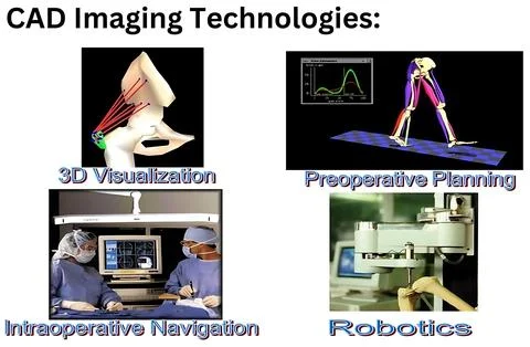 Advanced CAD Imaging Technologies for 3D Visualization and Surgical Navigatio Stock-Fotos