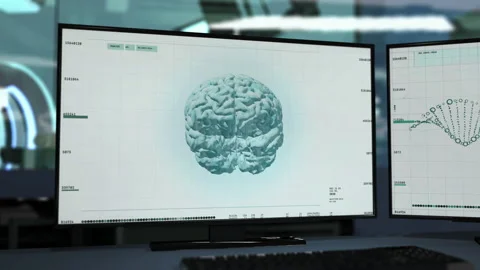 Advanced Human Brain Research Technology Conducts Thorough Health Care Scan Vídeo Stock 158297084