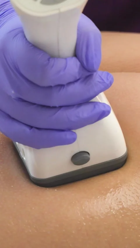 Advanced massage technologies. Laser massage device. Massage. Vertical video. 스톡 동영상 308070625