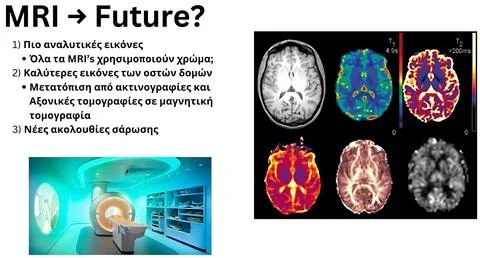 Advancing MRI Technologies: Enhanced Imaging, New Scanning Protocols, and F.. Stock Photos