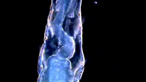 Aeolosoma Worms Observed Through High-Power darkfield Microscopy, 1000x 動画素材 317925791