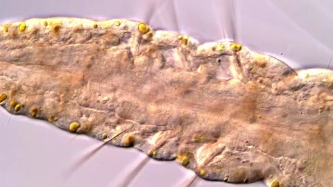 Aeolosoma Worms tail Under the Microscope 스톡 동영상 317926942