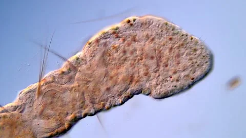 Aeolosoma Worms Under the Microscope in High Resolution Stock Footage 317925955