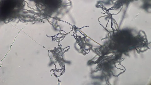 Aerial mycelium. Stock Footage 317881326