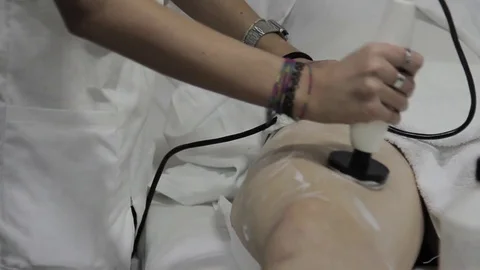 Aesthetic leg therapy Stock Footage 77336403