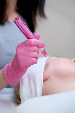 Aesthetician Using Dermapen on Client's Face Photos