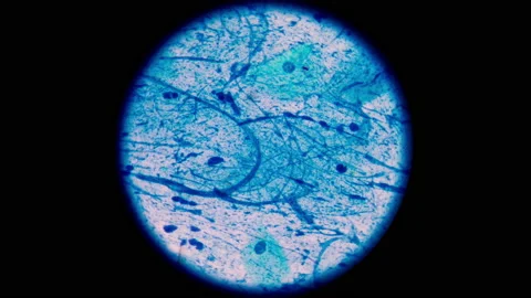 AFB Negative and Positive in stop motion footage. Stock Footage 200409732