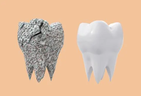 Affected broken molar tooth and clean white tooth Stock Illustration