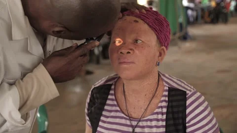 Africa eye surgeon checking and  treating patient eyes Video stock 165447744