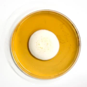 An agar plate with microorganisms Stock Photos