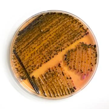 An agar plate with microorganisms Stock Photos