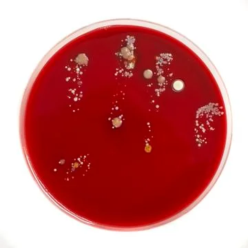 Agar plate with microorganisms Stock Photos