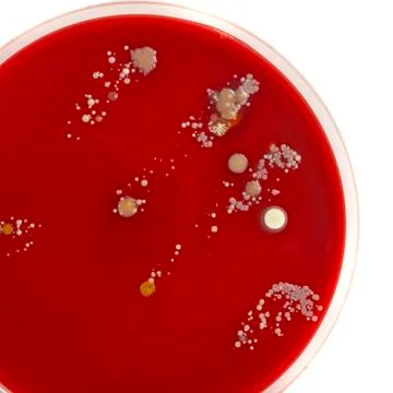 Agar plate with microorganisms Stock Photos