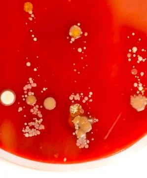 Agar plate with microorganisms Stock Photos