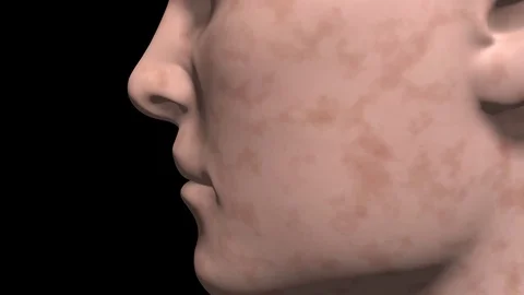 Age spots vanish from skin.Static face view. 3d animation 库存影片 82286201