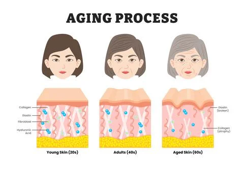 Aging process, educational medical poster design healthcare scheme, labeled.. Stock Illustration
