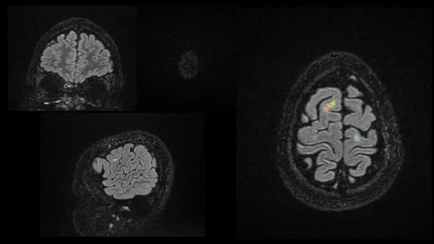 AI in radiology MS Stock Footage 109826691