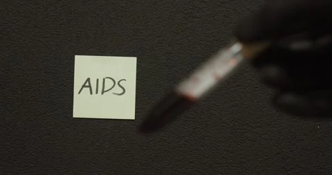 AIDS Blood Test Focus Shift – Medical Diagnosis Concept Stock Footage 334778779