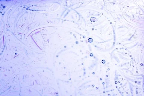 Air bubbles inside water base form patterns Stock Illustration