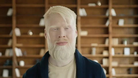 Albino guy looking at camera and nodding head, winking eye with smile 4K slow Stock Footage 255327072