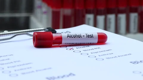 Alcohol test to look for abnormalities from blood Stock Footage 237448855