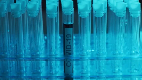 Alert in lab. Close-up of scientific laboratory in hospital. Epidemic disease Stock Footage 126478595