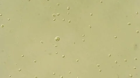 Algae bloom analys under microscope, magnification 100X Vídeos de archivo 65777115