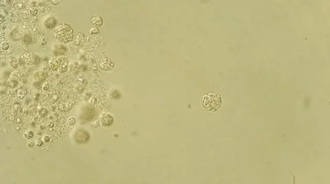 Algae bloom analys under microscope, magnification 100X Vídeos de archivo 65789584