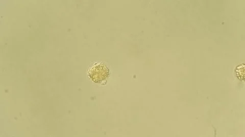 Algae bloom analys under microscope, magnification 100X Vídeos de archivo 65789627