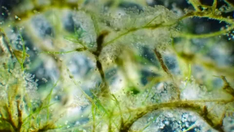 Algae with Peritrich Ciliates, Copepods, Darkfield 2x lens, vibrant microscopy Stock Footage 319387678