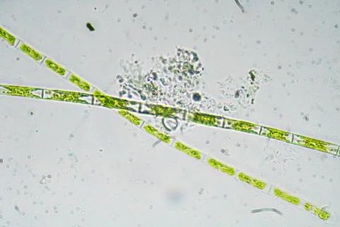 Algae under a microscope. The microscopic world. Photos