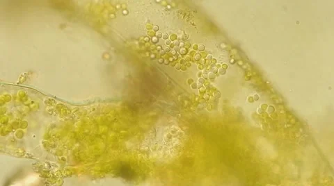 Algae Vausheria (algae bloom) under microscope, magnification 100X Vídeos de archivo 65774133
