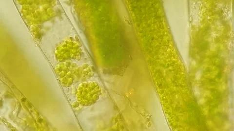 Algae Vausheria (algae bloom) under microscope, magnification 100X Video stock 65789638