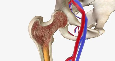 ALL originates in cells in the bone marrow called lymphoblasts Stock Illustration