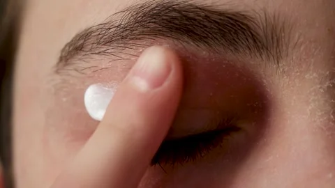 Allergic patient applying ointment to dry eyelid skin affected by dermatitis Stock Footage 319975365