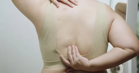 Allergies and skin diseases. Stock Footage 288116523