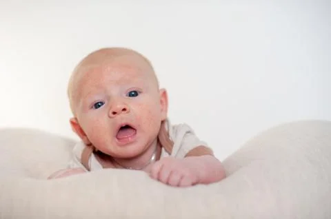 Allergies, atopic dermatitis on the face Stock Photos