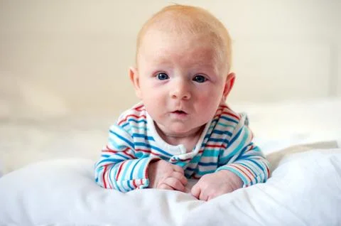 Allergies, atopic dermatitis on the face Foto stock