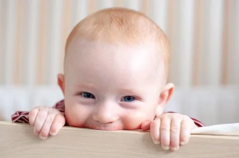 Allergies, atopic dermatitis on the face Stock Photos