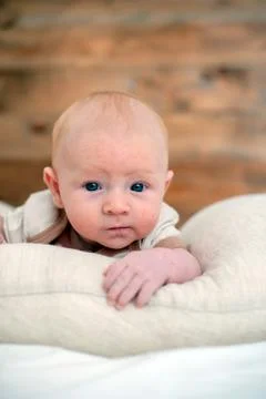Allergies, atopic dermatitis on the face Stock Photos