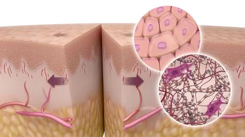 Allergies, which can occur due to various reasons and in many different ways, Stock Illustration
