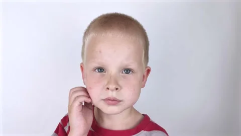 An allergist or dermatologist examines red spots on a child’s face. The boy suff Stock Footage 134704223