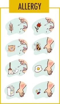 Allergy factor and man Vector illustration Stock Illustration