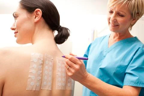 Allergy patch test Stock Photos