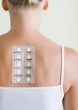 Allergy test Stock Photos