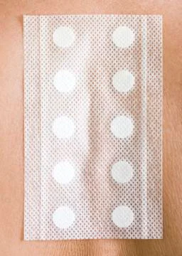 Allergy test Stock Photos