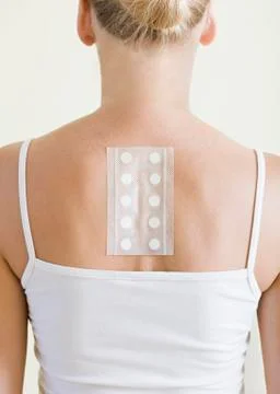 Allergy test Stock Photos