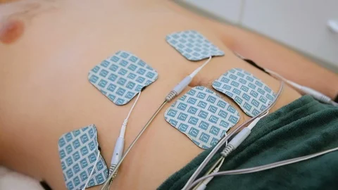 Alternative electrostatic massage of male belly in spa center. Anti aging Stock Footage 111830585